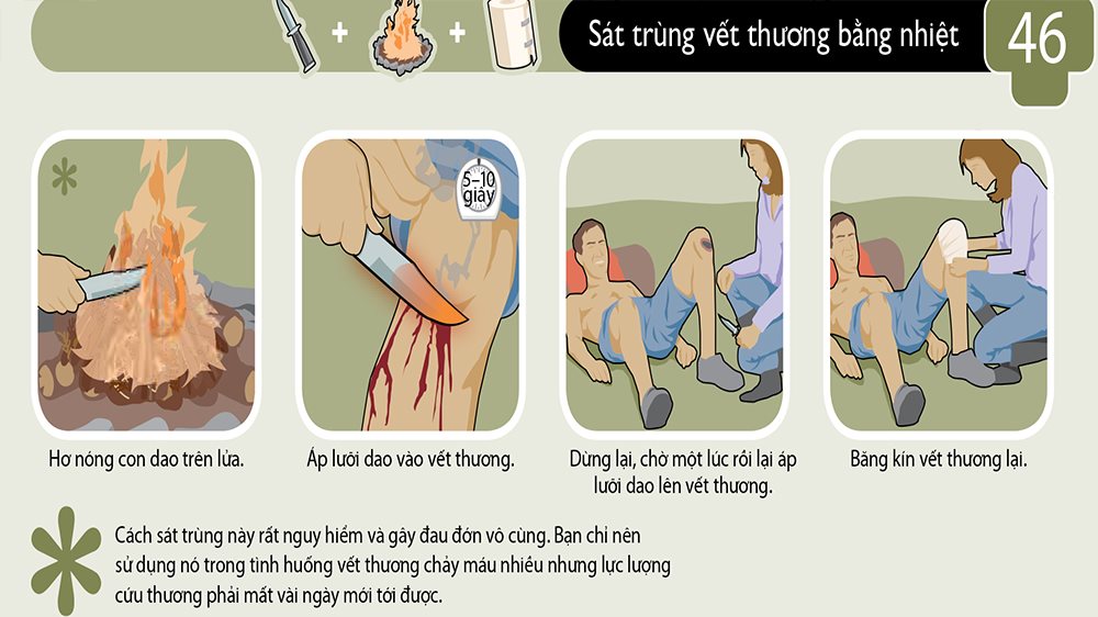 Cách cầm máu và băng bó vết thương